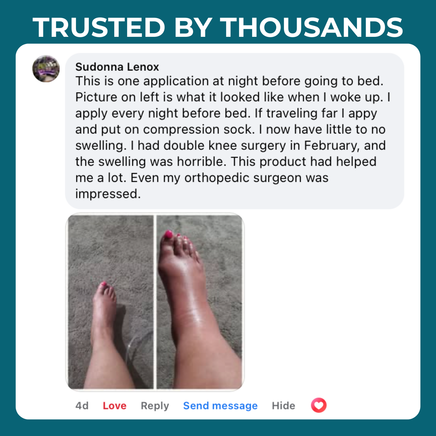 Tryzovira Miracle Balm™ Herbal Powerhouse